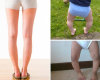 Вальгусная деформация нижних конечностей у детей: особенности, причины и лечение