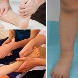 Как делать массаж детям при вальгусной деформации? ⚕️  