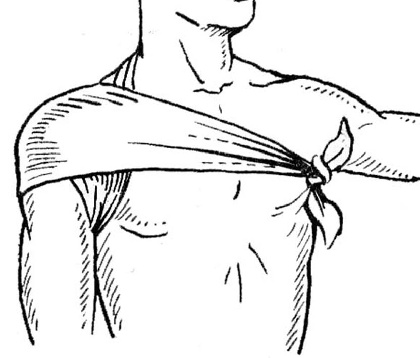 Техника выполнения колосовидной повязки на плечевой сустав