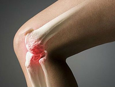 Диета при остеоартрозе коленного сустава